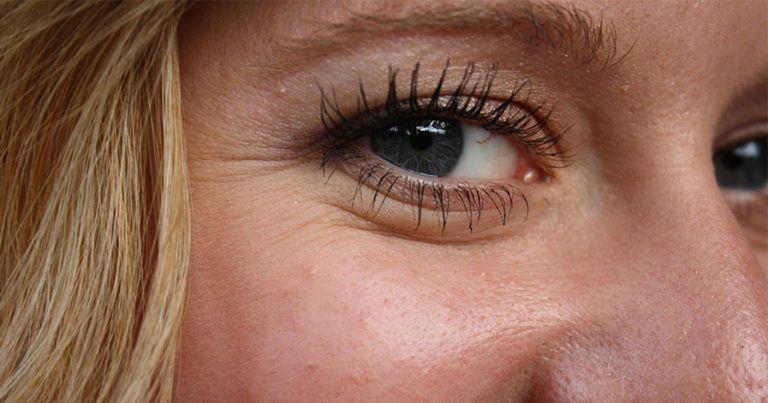 Wrinkles around eyes