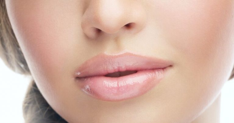 Botox injected lips.